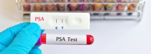 Prostate Cancer Test